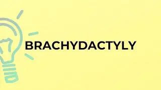What is the meaning of the word BRACHYDACTYLY?