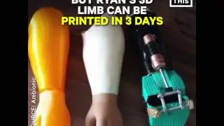 Dad made 3D printed arm for his kid