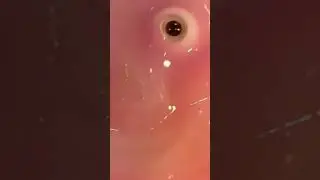 Robot Made From Actual Human Skin