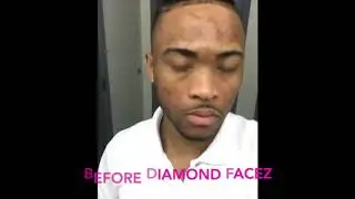#dftv diamondfacez certified ninja