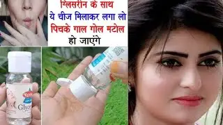 इसकी सिर्फ दो बूंद रात में लगालो 7 दिनों में पिचके हुए गाल गोल मटोल सुंदर हो जाएंगे| Chubby Cheeks