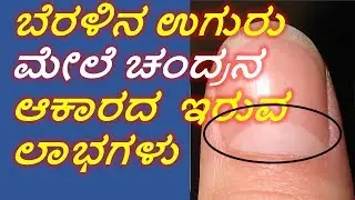 Benefits of having moon shaped white mark on finger's nail | Nimage Gottha