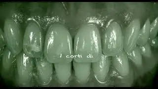 i corti: i pictures control