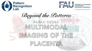 Beyond the Patterns 49 - Farah Deeba – Multimodal Imaging of the Placenta