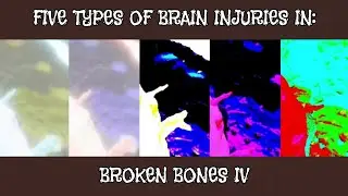 Broken Bones IV: All Five Types Of Brain Injuries