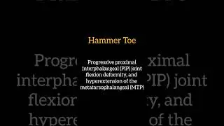 Hallux Valgus and Hammer Toe... 