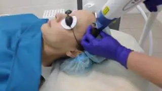 Лазерное удаление гемангиом