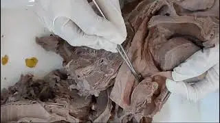 Larynx features