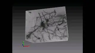 3D reconstruction of  Golgi–Cox impregnated neurons.