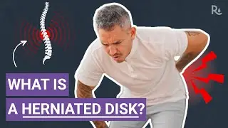 What is a Herniated Disk? Does it Cause Low Back Pain?