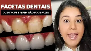 Can you put dental veneers? Find out who can and who can't do dental veneers