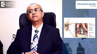How Does ACL Get Injured? | Ligament Treatment | MCL | LCL | PCL - Manipal Hospitals
