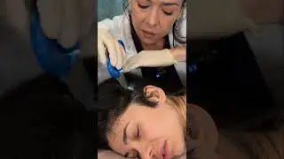 Asmr scalp tingles #asmr #asmrsounds #asmrvideo #relax #relaxing #satisfying #hair #sleep #tingles