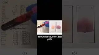 الحق اشترك معانا فى أقوى كورس هيماتولوجى اونلاين فى انتظاركم 🫶❤️ Hematology