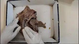 Nasal cavity