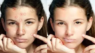 How to remove pimples [Android Version | Photoshop Express ]