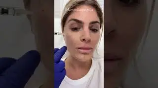 Would you try the non-surgical glow up by Dr. Simon Ourian?