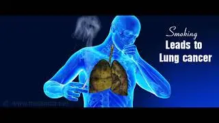 mesothelioma commercial script