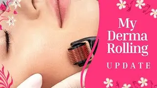 ✅ Its Been a While my Derma Rolling UPDATE #beauty | Rocks Steady