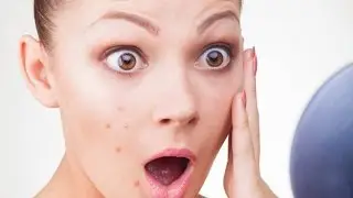 Cách tẩy xóa mụn cực kỳ đơn giản trong Photoshop