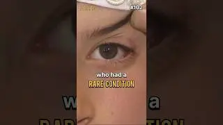 A Rare Condition | #102