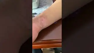 가오홍궈 하이라이트 영상 O xdu j jmvvkgus 高洪国       xuukvu dr