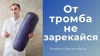 От тромба не зарекайся. Как варикоз перешел в тромбоз. Флеболог Москва.