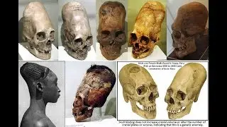 Analysis of the Elongated Paracas Skulls. Nephilim?