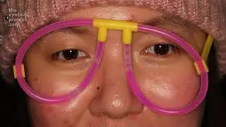 The Eye Love Project