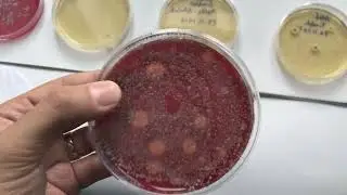 Mikrobiyolojik Testler