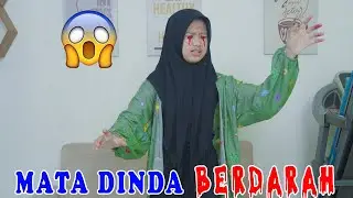 DRAMA || DINDA'S EYES BLOODED