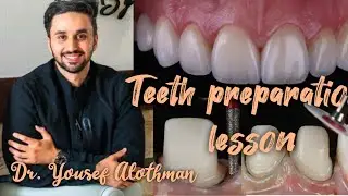 Lesson of preparation of teeth of frontal group. Dr. Yousef Alothman. Orthopedic dentistry.