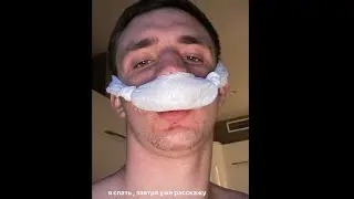Литвин сломол нос. Как Литвин сломал нос