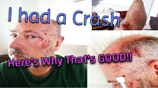 I had an Accident - Here's Why That's a Positive!
