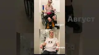 Как врачебная ошибка привела к инвалидности
