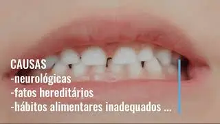 BRUXISMO INFANTIL! saiba mais ....