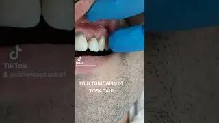 ТИШНИ ТОШИДАН ТОЗАЛАШ !!!