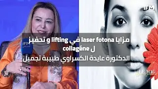 مزايا laser fotona في lifting و تحفيز ل collagéneالدكتورة عايدة الكسراوي طبيبة تجميل