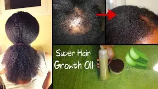 I Promise you!! This is the best Hair Growth OIL U will ever make. HAIR GROWTH RESULTS IN ONE MONTH.