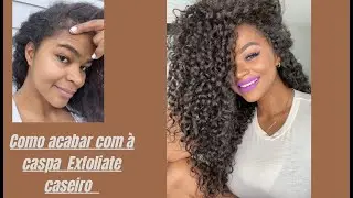 Como Acabar Com a Caspa Do Couro  Cabeludo \Usando EXFOLIANTE CASEIRO