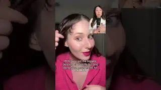 Postpartum Hair Loss is REAL 😭 | Dermatologist Reacts + Why It Happens!