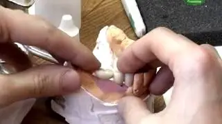 Сорока62.Линия жизни.Центр по борьбе со СПИДом  и ИЗ, Дента Стиль