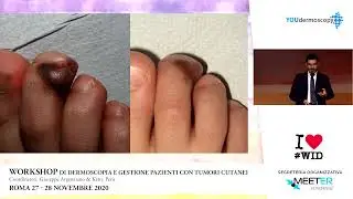 06| Update su gestione tumori cutanei - G. Argenziano