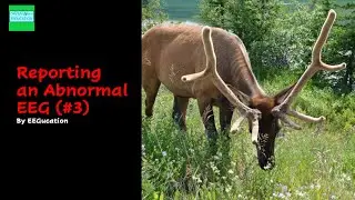 Review of an Abnormal EEG (#3)
