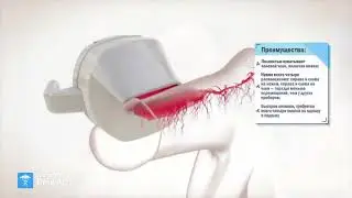 Ударно волновая Renova | Dein Arzt