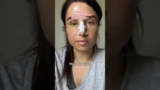 Go Behind The Scenes of a Rhinoplasty Procedure | Dr Julian De Silva