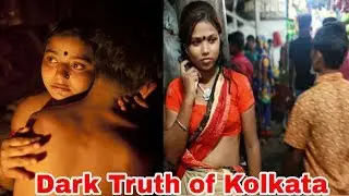 कोलकता का कला सच |Truth of Kolkata | Dark Facts of west Bengal