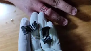 Parmaktan  Çıkarılan Somunun Bıraktığı İz😨😨😨