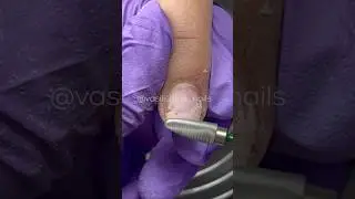 К чему приводят базы!❌😨😱 #маникюр #маникюробучение #ногти #nails #shorts #комбиманикюр