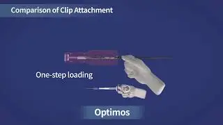 Optimos™_Hemo Clip 3D Animation